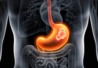 Cancer Management (Non-operative Phase)