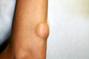 General Surgical Conditions