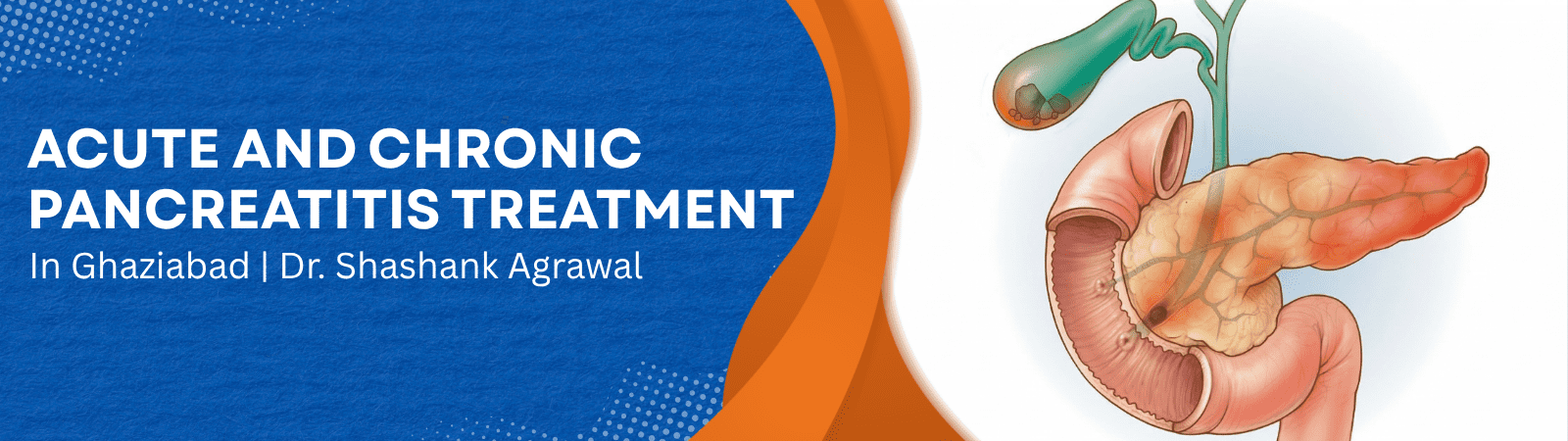 Acute and chronic pancreatitis treatment in Ghaziabad<br />
