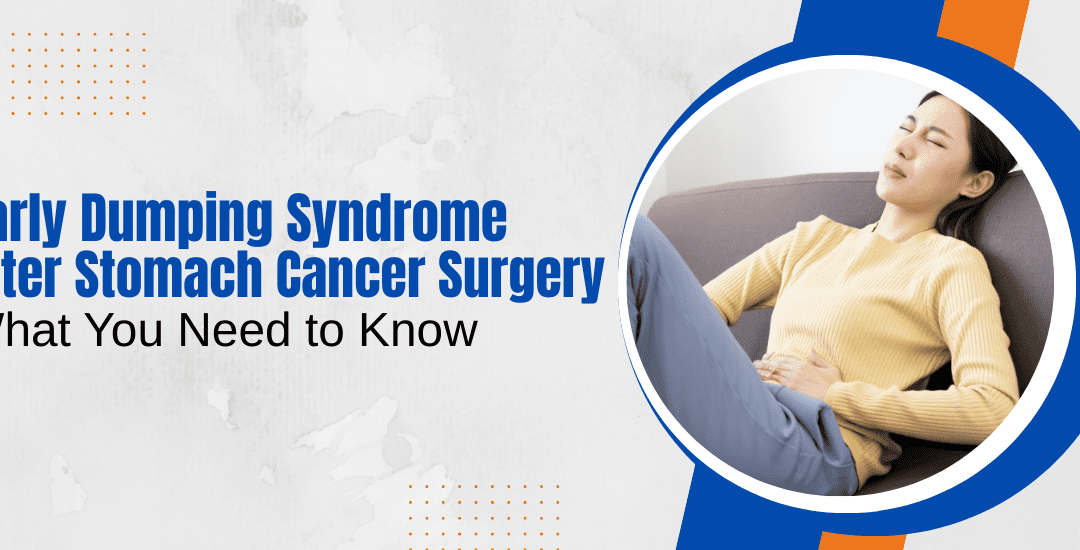 Early dumping syndrome after stomach cancer surgery
