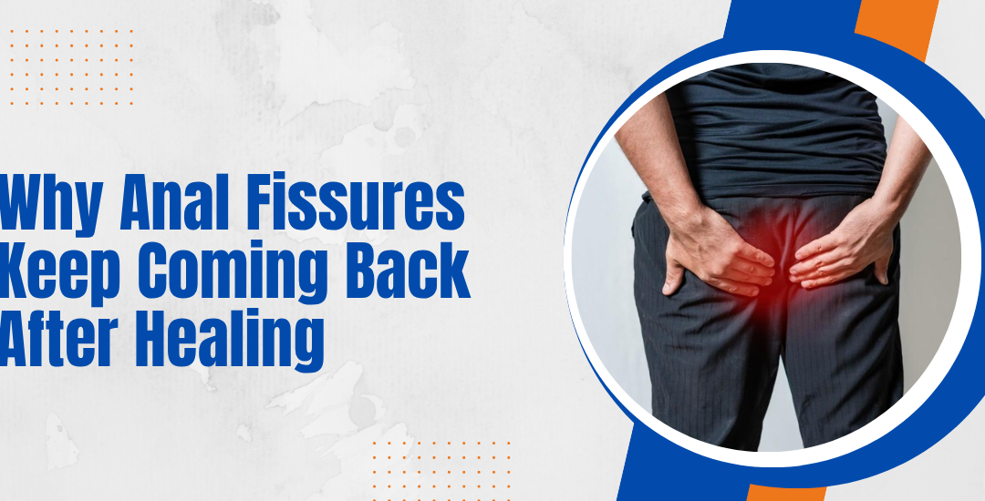 Why Anal Fissures Keep Coming Back After Healing?