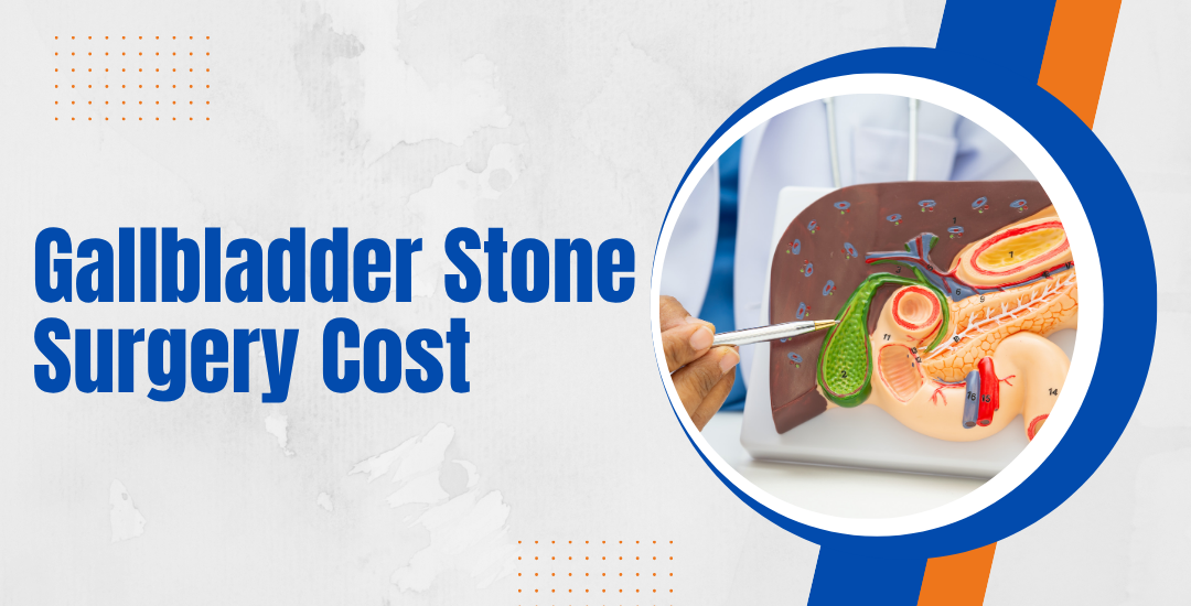 How Much Does Gallbladder Stone Surgery Cost in Ghaziabad?