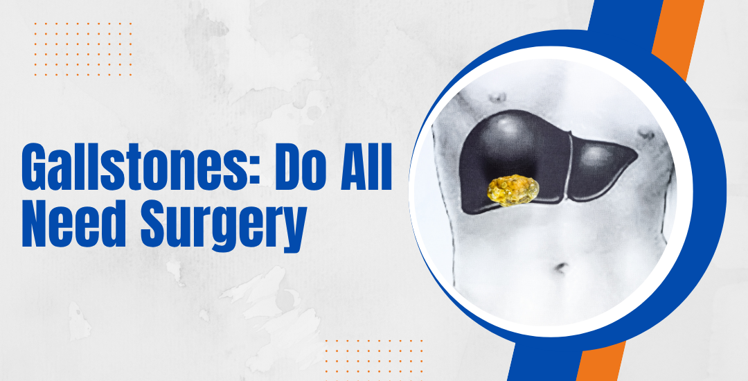 Gallstones Do All Need Surgery