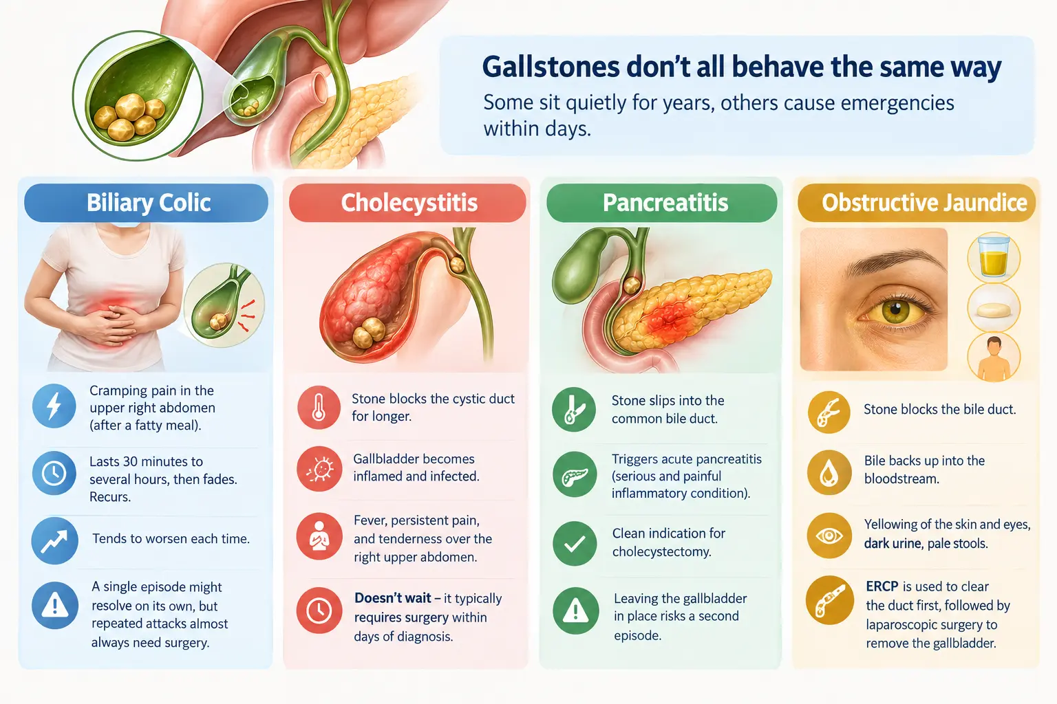 Gallstones and Their Complications - gisurgeryexpert.com/ Gallstones and Their Complications