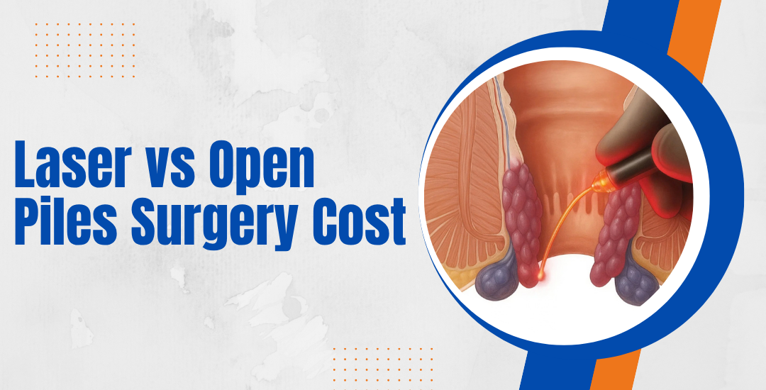 Is Laser Piles Surgery More Expensive Than Traditional Surgery in Ghaziabad?