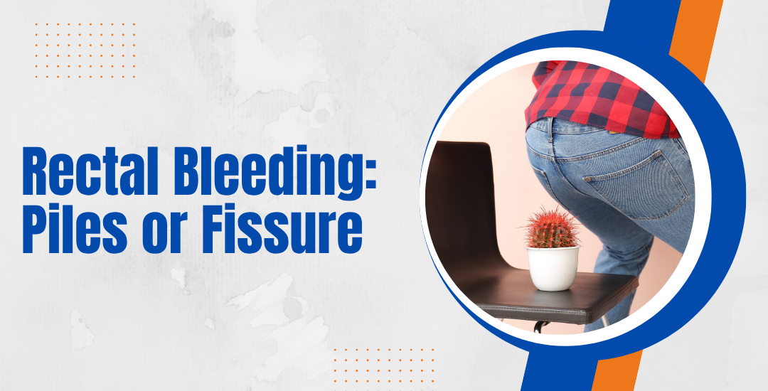 Is Rectal Bleeding Always Piles or Fissure, or Could It Be Something More Serious?