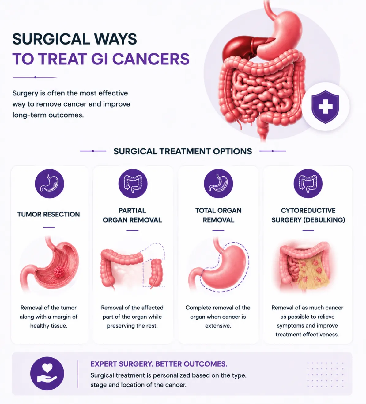 image9 - gisurgeryexpert.com/ Infographic on GI cancer surgery options: tumor resection, partial organ removal, total organ removal, and cytoreductive surgery (debulking).